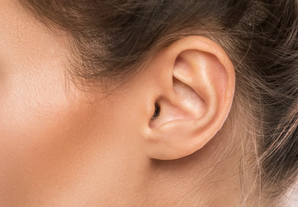 Otoplastie - Chirurgie des oreilles à Toulouse