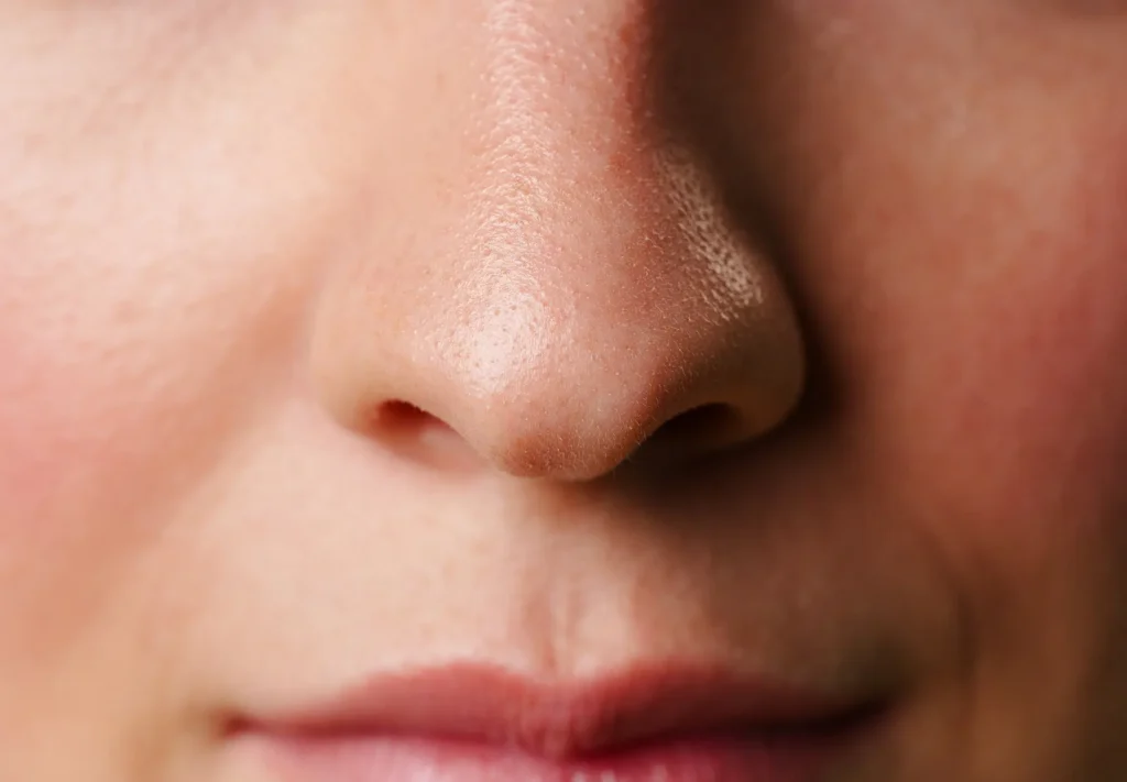 Rhinoplastie à Toulouse